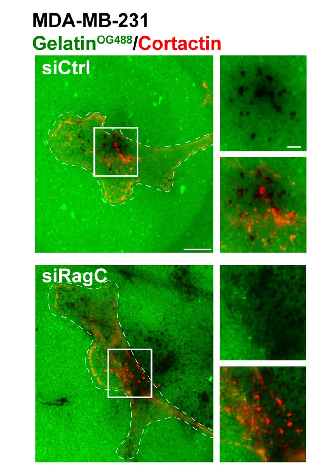 Open access visualization of Microscopy, MDA-MB-231 Cells, RagC Expression, Gelatin, Cortactin