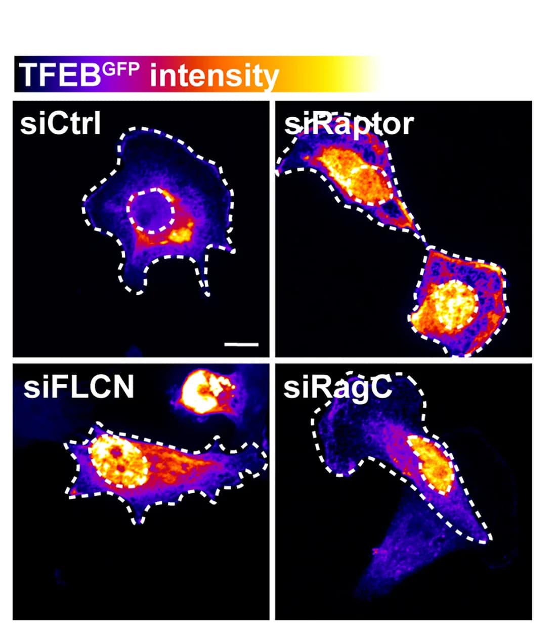 Open access visualization of Microscopy, TFEBGFP, MDA-MB-231 Cells, siRNAs, DAPI