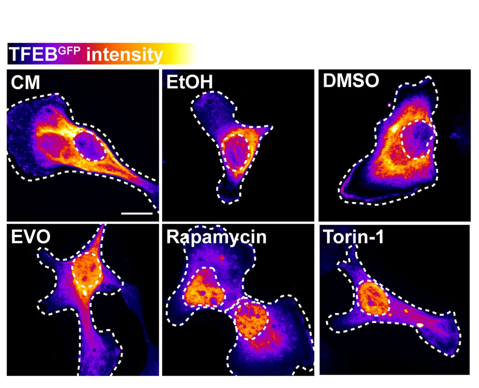Open access visualization of Microscopy, TFEBGFP, MDA-MB-231 Cells, Drugs