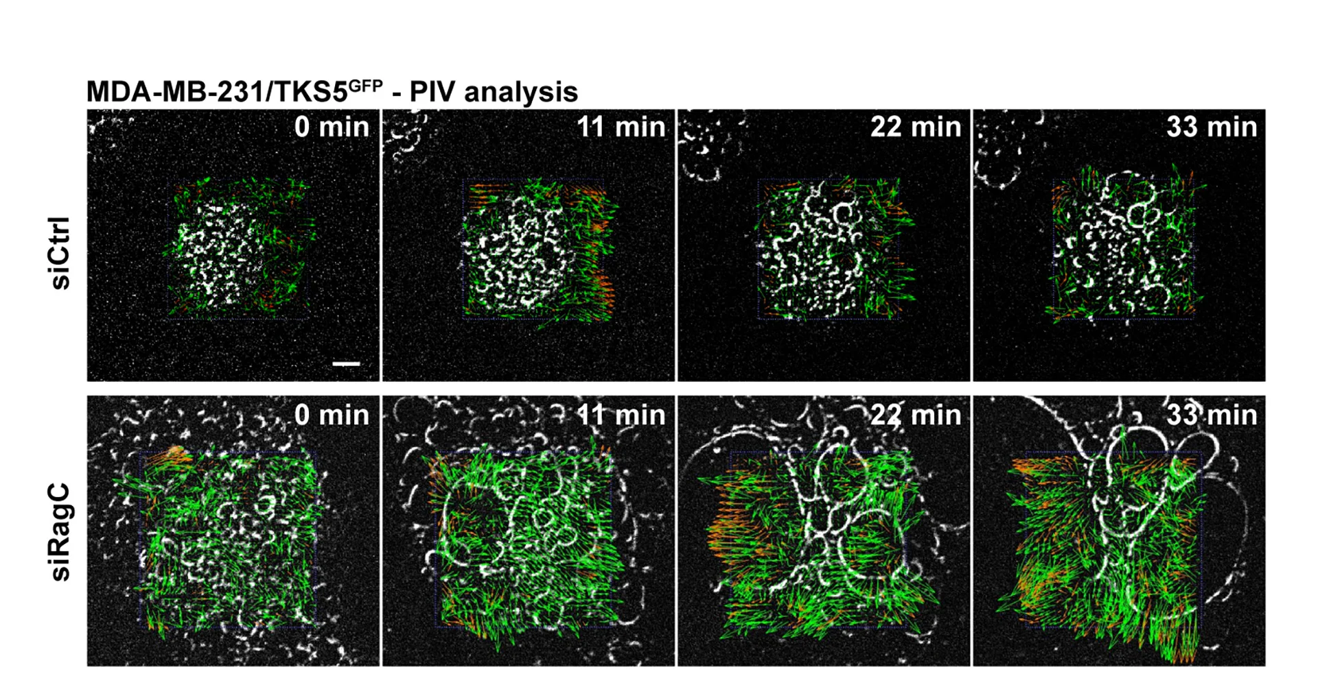 Open access visualization of Microscopy, MDA-MB-231, TKS5GFP, RagC siRNA, Type I Collagen
