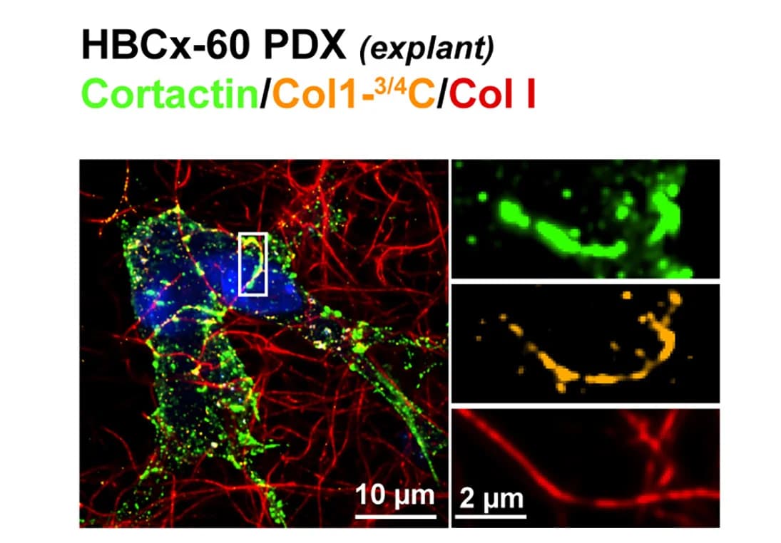 Open access visualization of Microscopy, TNBC PDX Cells, HBCx-90, Fibrillar Type I Collagen, Cortactin