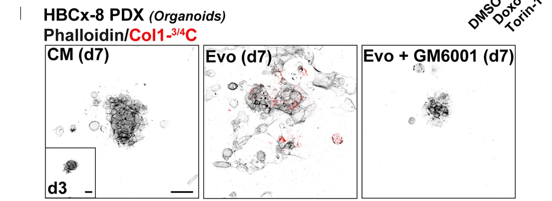 Open access visualization of Microscopy, Organoids, HBCx-8, 3D Type I Fibrillar Collagen, F-actin