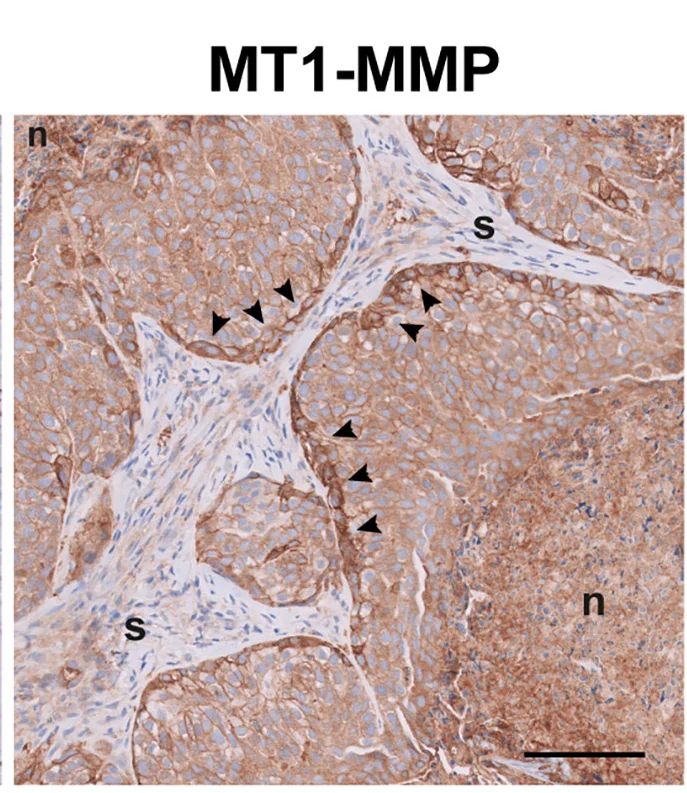 Open access visualization of Microscopy, MCF10DCIS Cells, RRAGC KO Cells, Tumor Xenografts, MT1-MMP