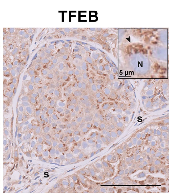 Open access visualization of Microscopy, MCF10DCIS Cells, RRAGC KO Cells, Tumor Xenografts, TFEB