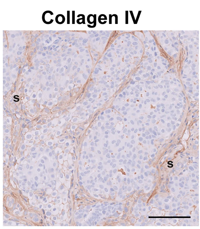 Open access visualization of Microscopy, MCF10DCIS Cells, RRAGC KO Cells, Tumor Xenografts, Collagen IV