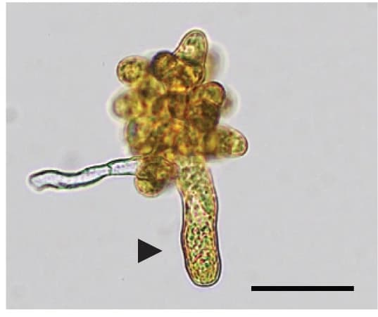 Open access visualization of Microscopy, Gametophyte, Mpyr_fem1, Gametangium