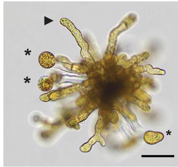 Open access visualization of Microscopy, Photo, Gametophyte, Mpyr_fem2, Gametangium
