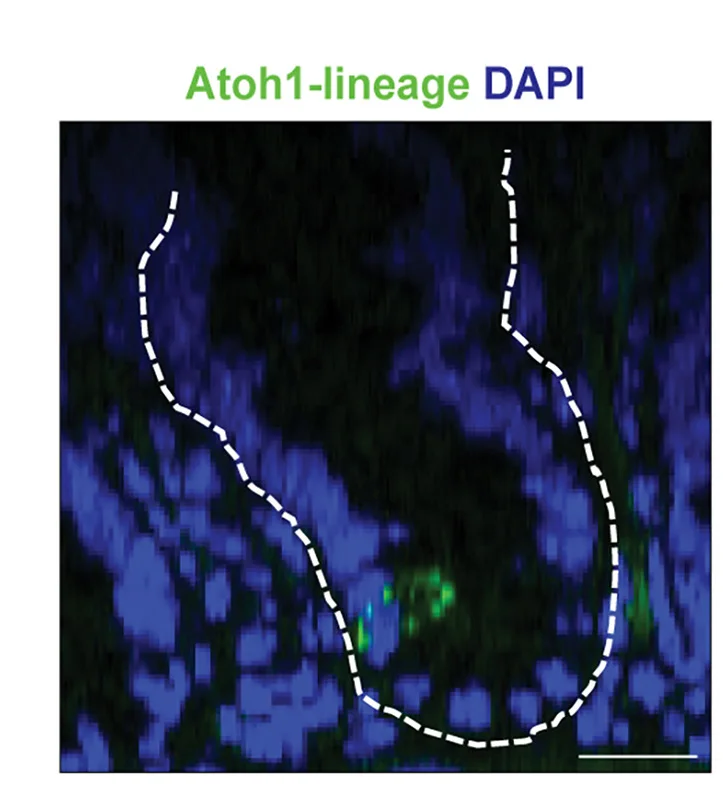 Open access visualization of Microscopy, Atoh1 Clone, mG, DAPI, Scale Bar