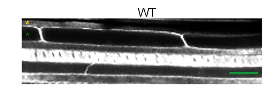 Open access visualization of Microscopy, Pectin Mutants, Cell-Cell Adhesion, Root, Calcofluor White