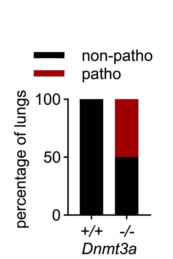 Open access visualization of Stacked Bar Plot, Lung Tissue, Pathology, Immune Infiltrates, Fibrosis