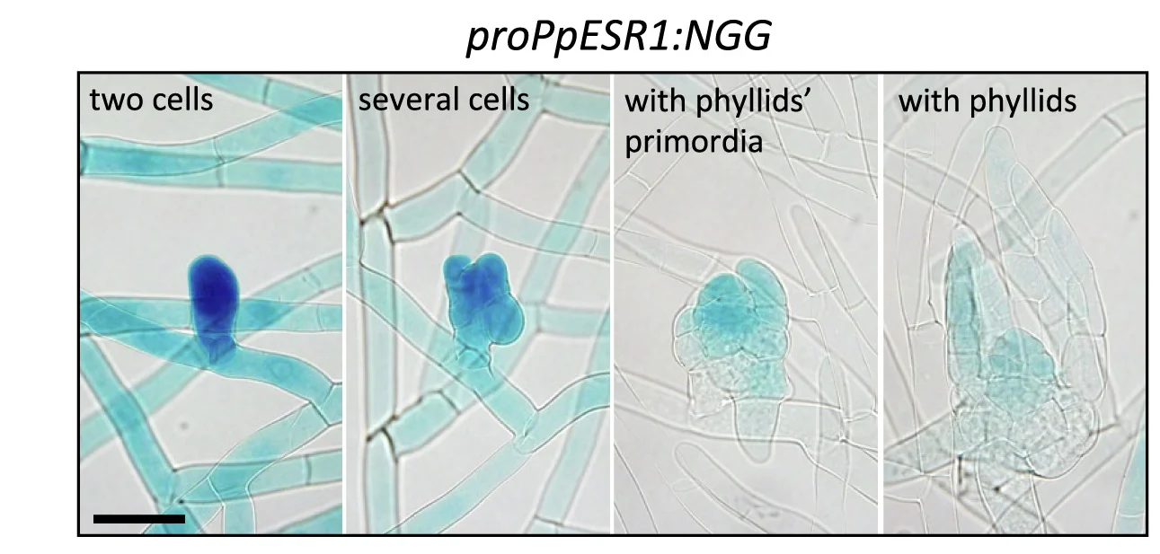 Open access visualization of Microscopy, Expression Patterns, Reporter Gene, GFP-GUS, PpESR1promoter