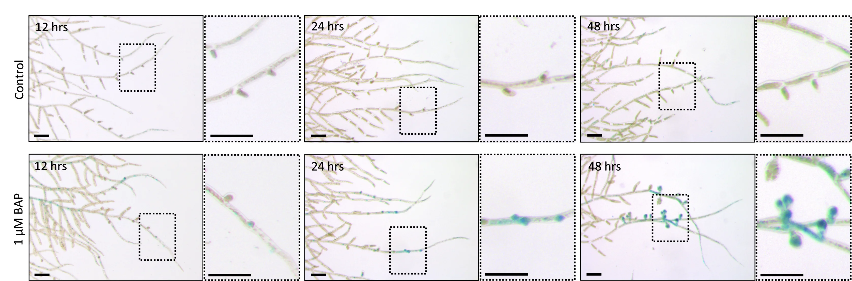 Open access visualization of Microscopy, Expression Patterns, Reporter Gene, GFP-GUS, PpESR1promoter