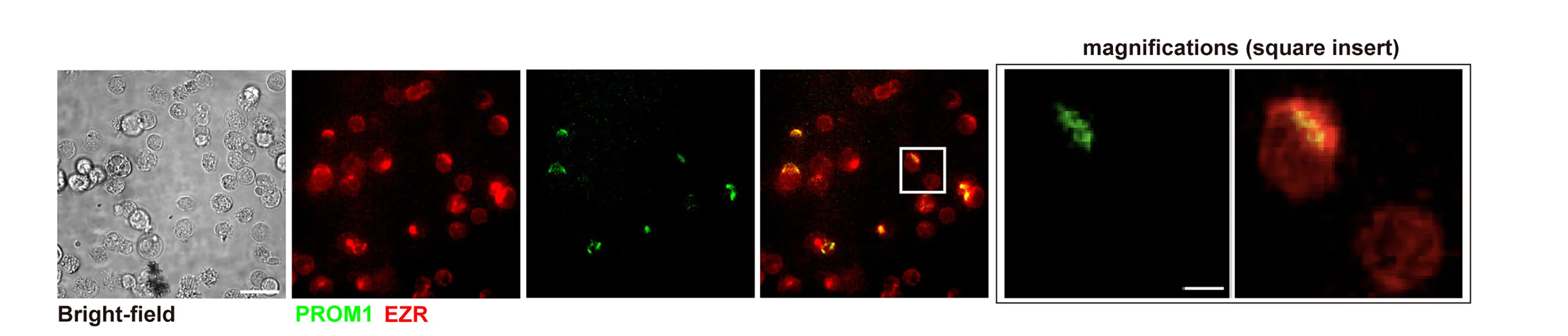 Open access visualization of Microscopy, Cells, Differentiating Cultures, PROM1+ Membrane, Phase-Contrast Image