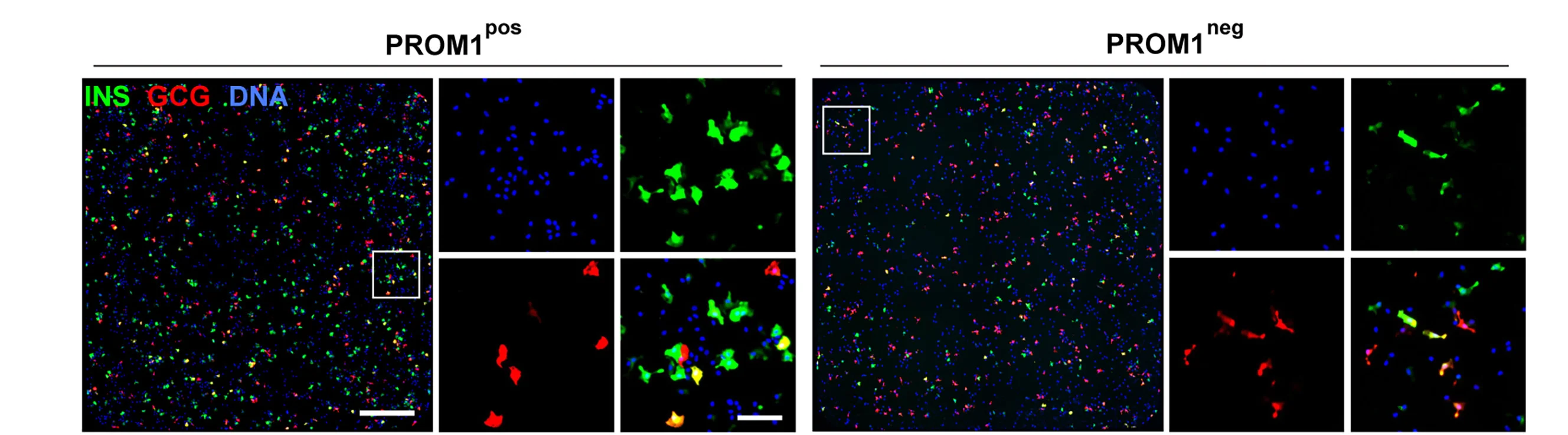 Open access visualization of Microscopy, Immunocytochemistry, INS, GCG Expression, PROM1+ EPs
