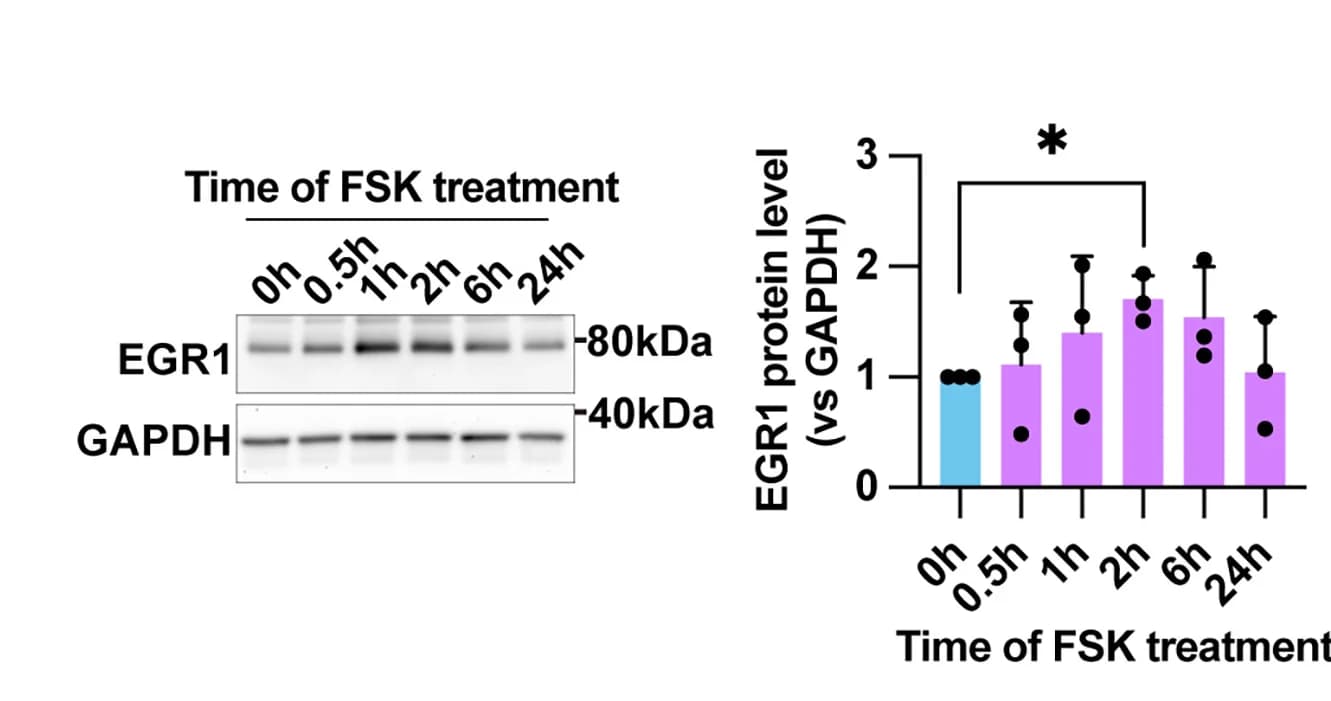 Open access visualization of Bar Plot, Error Bars, Gel, Western Blot, EGR1 Protein Levels