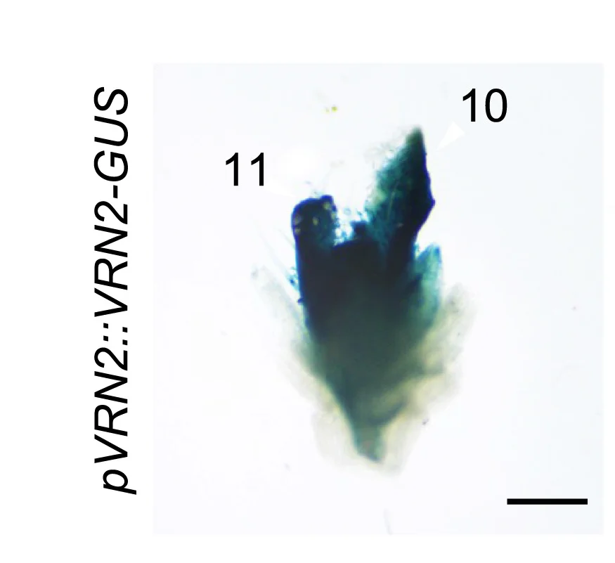 Open access visualization of Microscopy, Photo, Histochemical Staining, Rosette, Col-0