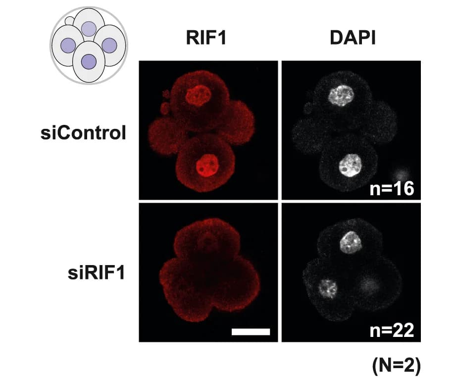 Open access visualization of Microscopy, RIF1 immunostaining, Microinjection, Embryos, Immunostaining