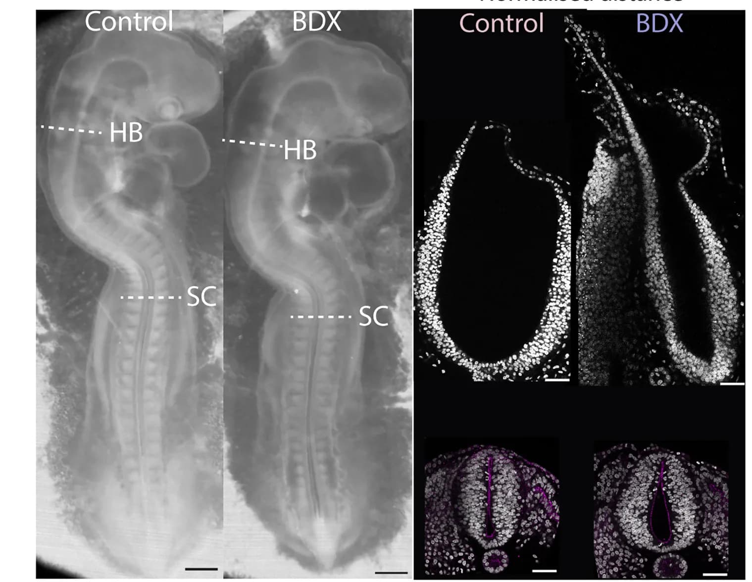 Open access visualization of Microscopy, Bright-Field Images, Control Embryos, BDX-Treated Embryos, Confocal Images