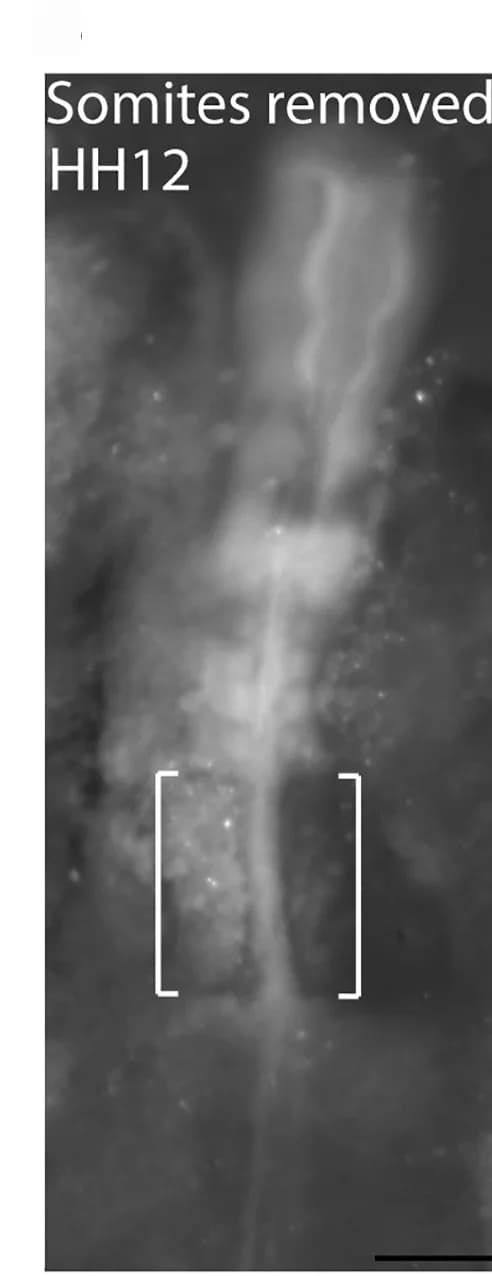 Open access visualization of Microscopy, Bright-Field Image, Embryo, Somites, Presomitic Mesoderm