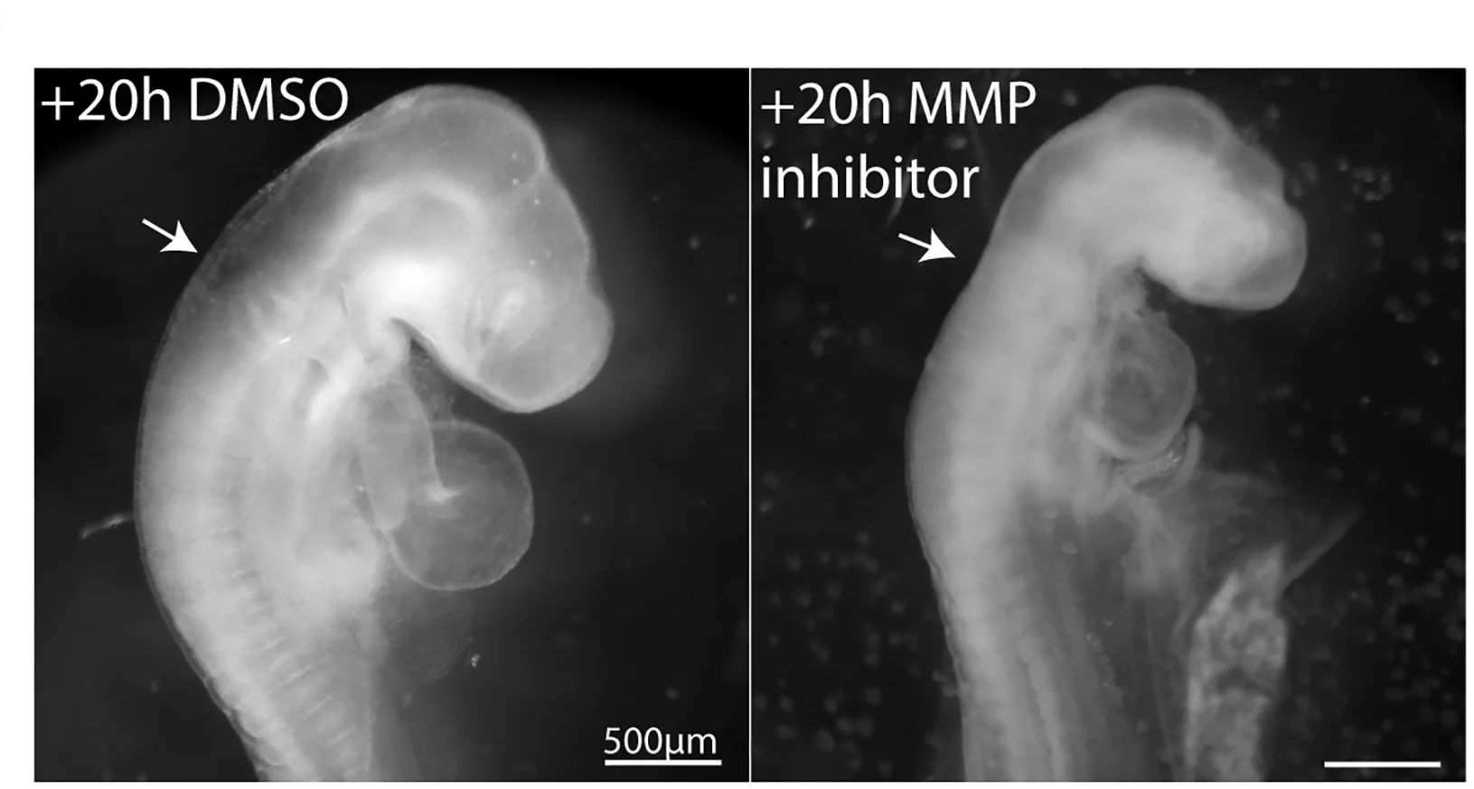 Open access visualization of Microscopy, Embryos, Dimethyl Sulfoxide, MMP Inhibitor, HH11