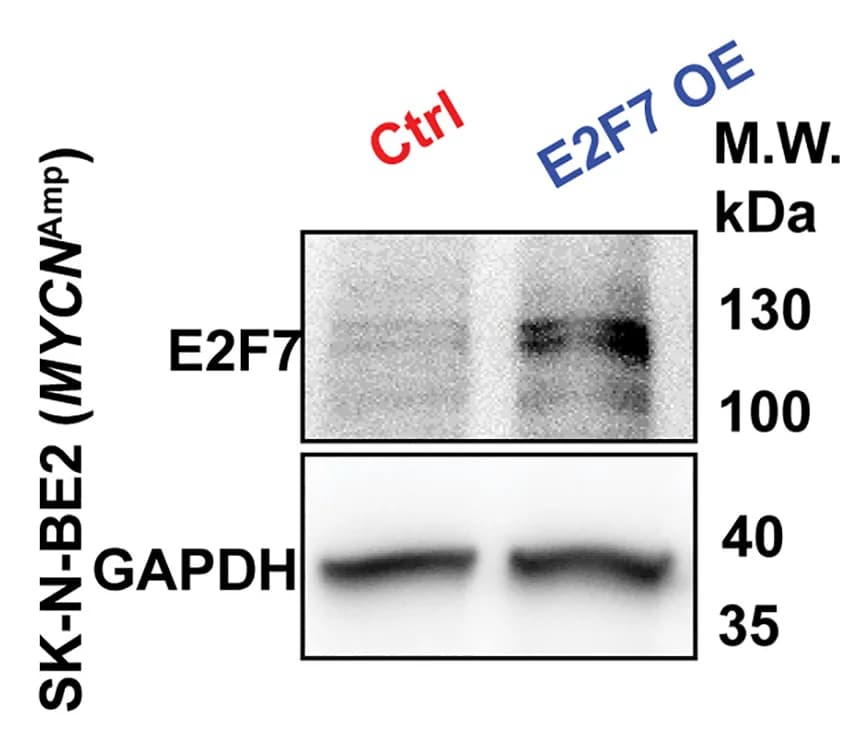 Open access visualization of Gel, Immunoblot Analysis, E2F7 Expression, SK-N-BE2 Cells, E2F7 Overexpression