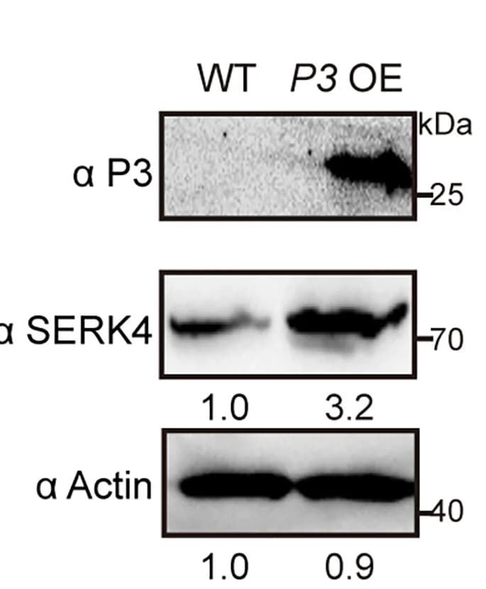 Open access visualization of Gel, Immunoblot Analysis, P3 Protein, SERK Protein, Transgenic Plants