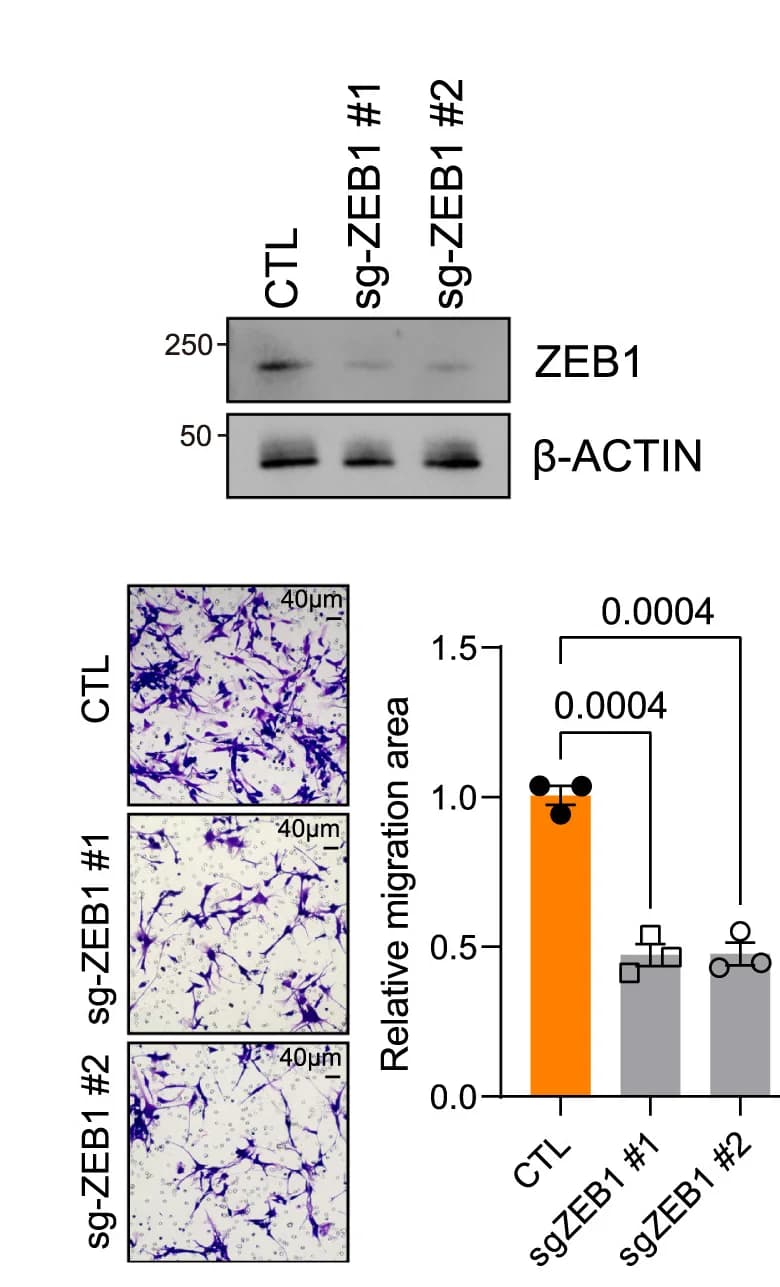Open access visualization of Bar Plot, Gel, Microscopy, Western Blot, ZEB1 Knockout