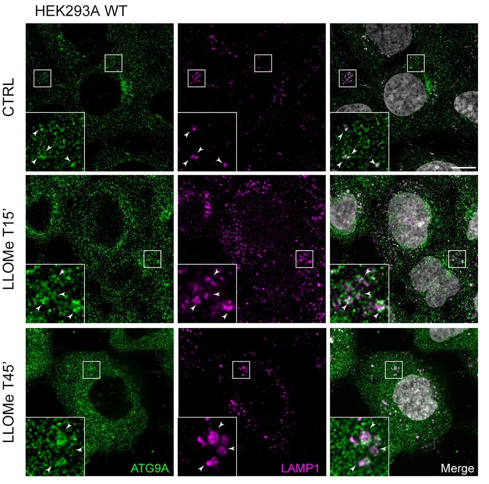 Open access visualization of Microscopy, Immunofluorescence, HEK293A WT, LLOMe, Scale Bar