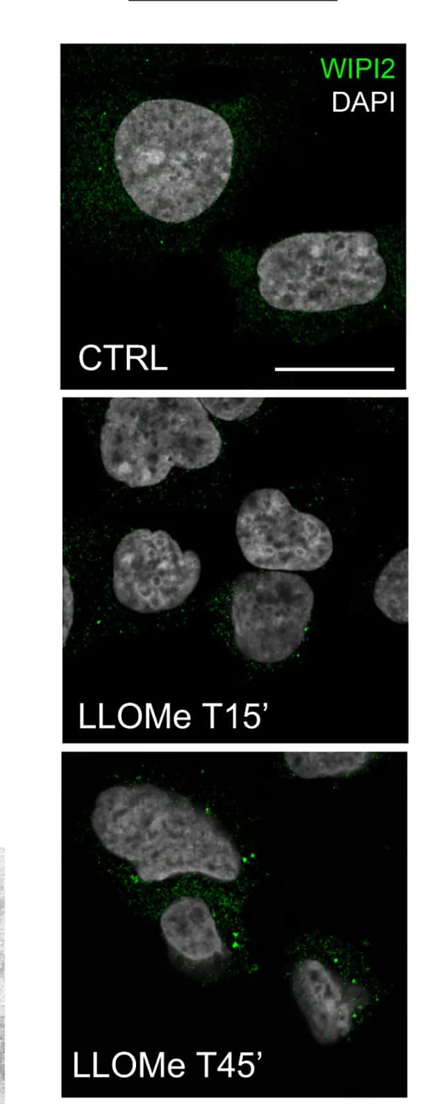Open access visualization of Microscopy, Immunofluorescence, HEK293A WT, LLOMe, Scale Bar