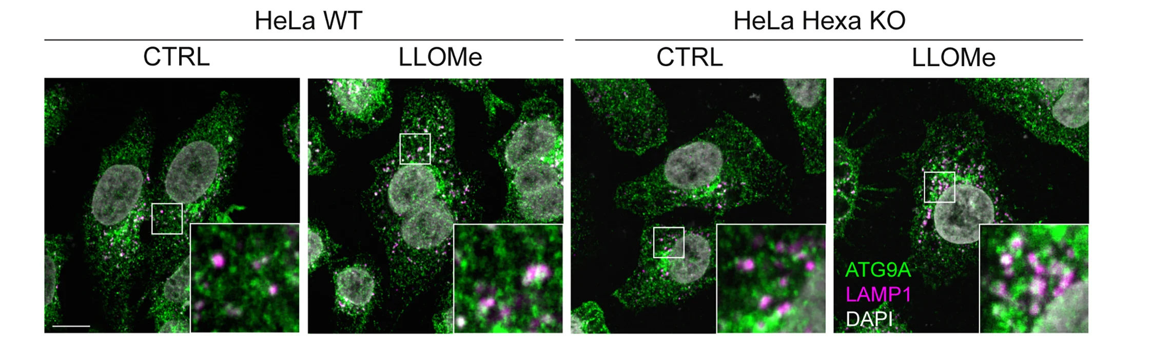 Open access visualization of Microscopy, Immunofluorescence, HeLa WT, Hexa KO Cells, LLOMe