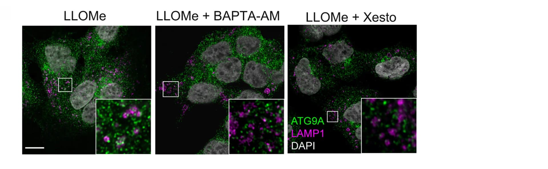 Open access visualization of Microscopy, Immunofluorescence, HEK293A, BAPTA-AM, Xestospongin C