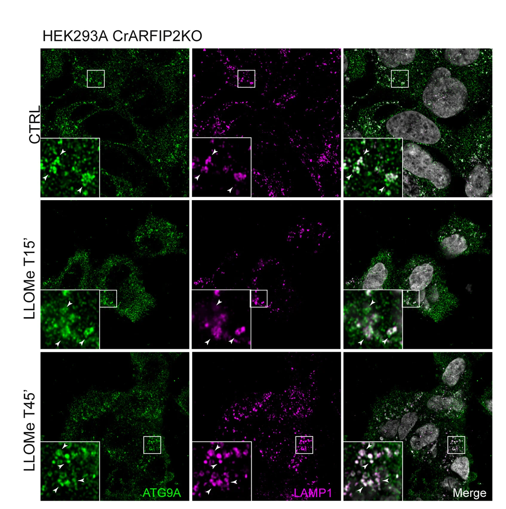 Open access visualization of Microscopy, Immunofluorescence, CrARFIP2KO Cells, LLOMe
