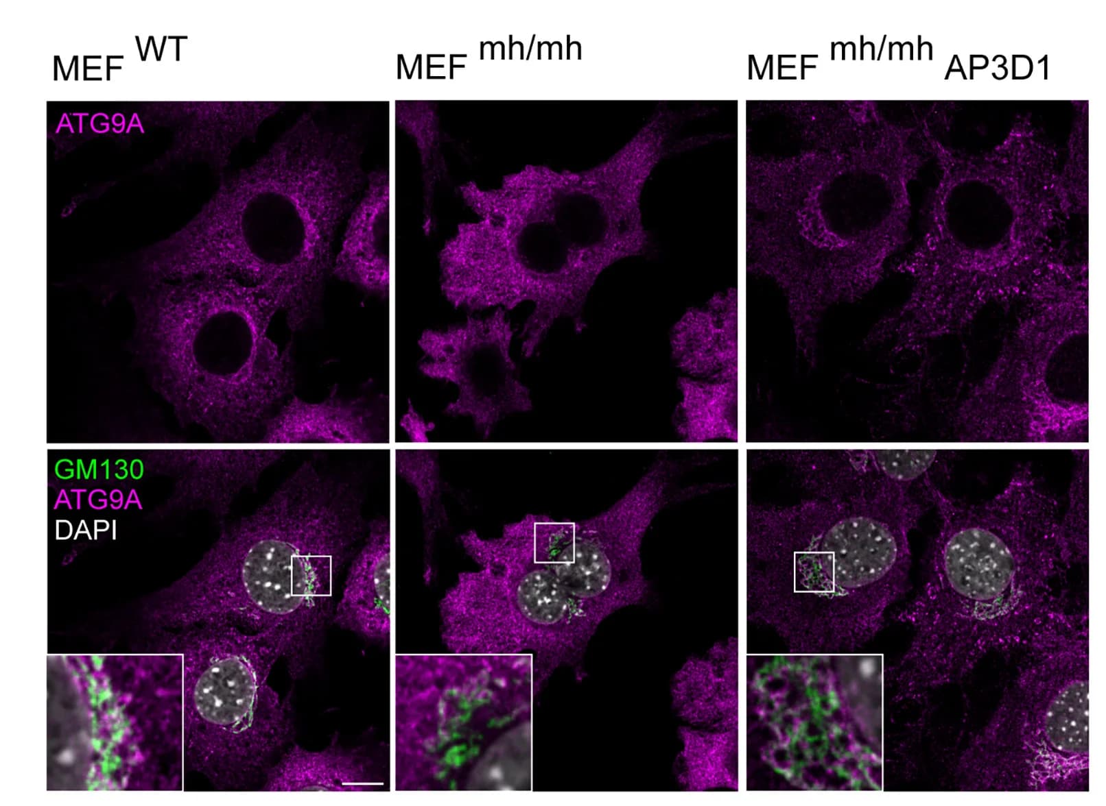 Open access visualization of Microscopy, Immunofluorescence, MEFWT, MEFmh/mh, AP-3D1