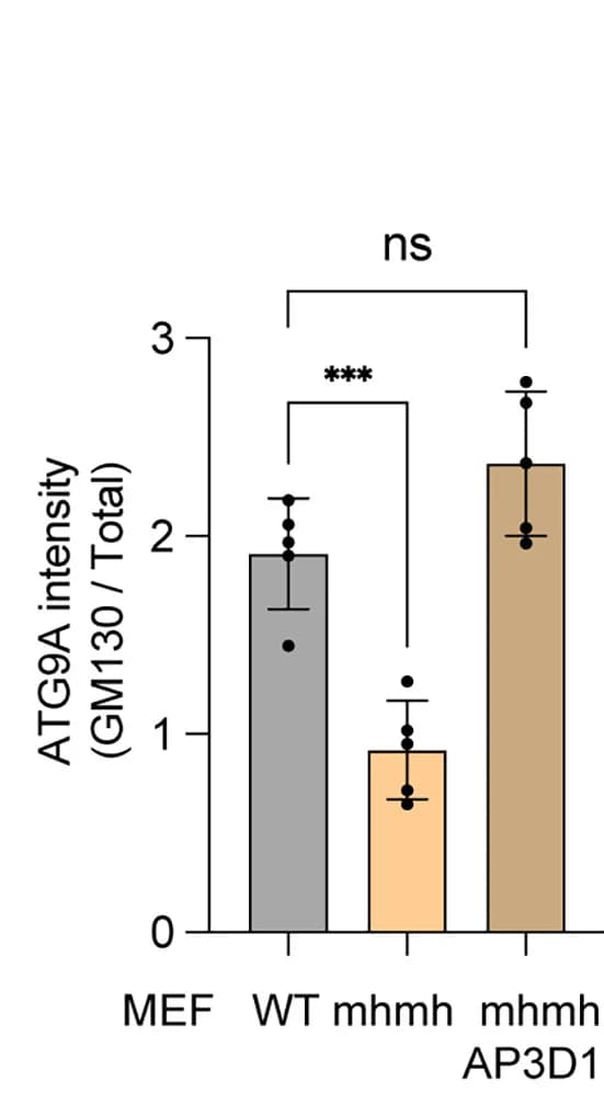 Open access visualization of Bar Plot, Error Bars, Quantification, ATG9A, Golgi