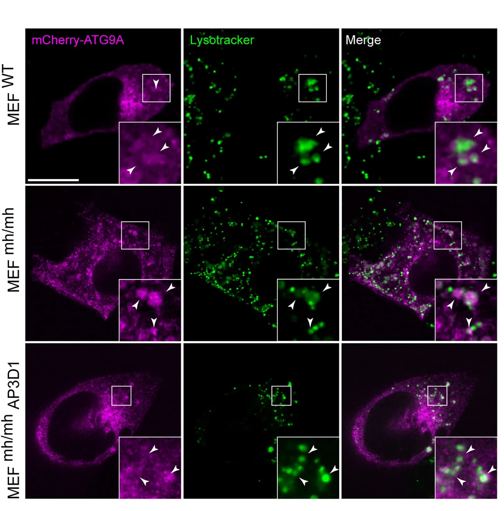Open access visualization of Microscopy, Live Imaging, MEFWT, MEFmh/mh, AP-3D1