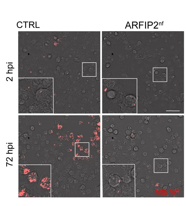 Open access visualization of Microscopy, Mycobacterium Tuberculosis, HMDM, ARFIP2