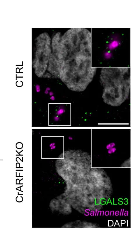 Open access visualization of Microscopy, Immunofluorescence, Salmonella, mCherry, ARFIP2