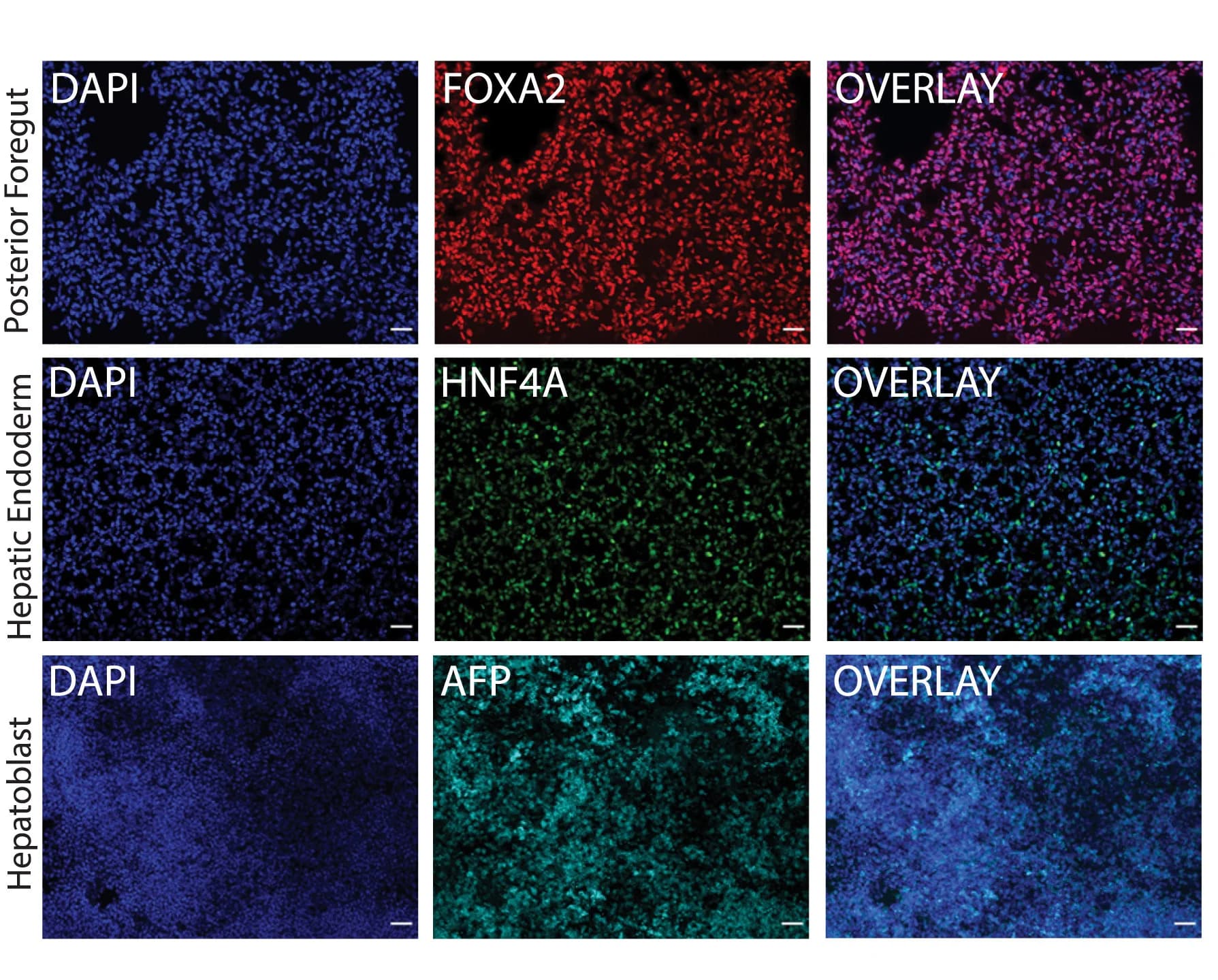 Open access visualization of Microscopy, FOXA2, HNF4A, AFP, Hepatic Progenitors
