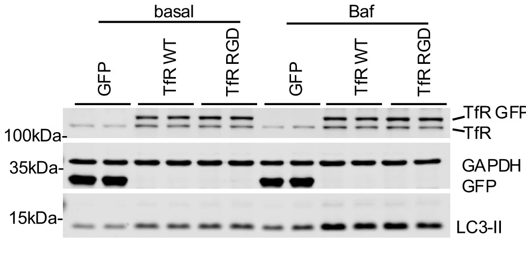 Open access visualization of Gel, HeLa Cells, Transfection, pEGFP Empty Vector, TfR-GFP-WT