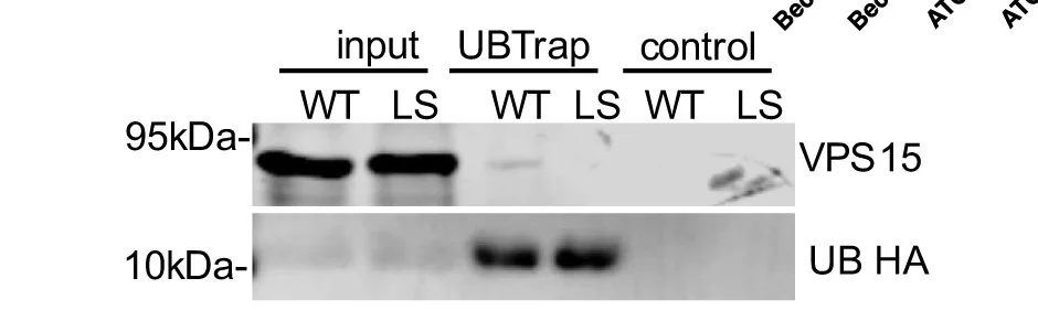 Open access visualization of Gel, VPS15, Fusion Proteins, Ubiquitin, Immunoprecipitation