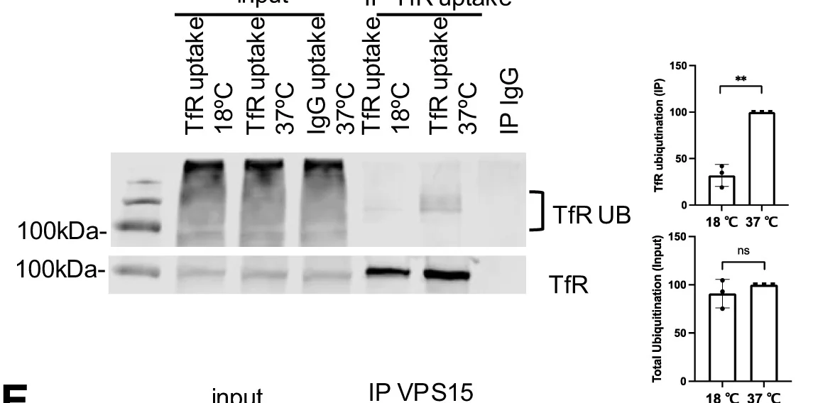 Open access visualization of Gel, Bar Plot, Error Bars, HeLa Cells, MARCH8 GFP Construct