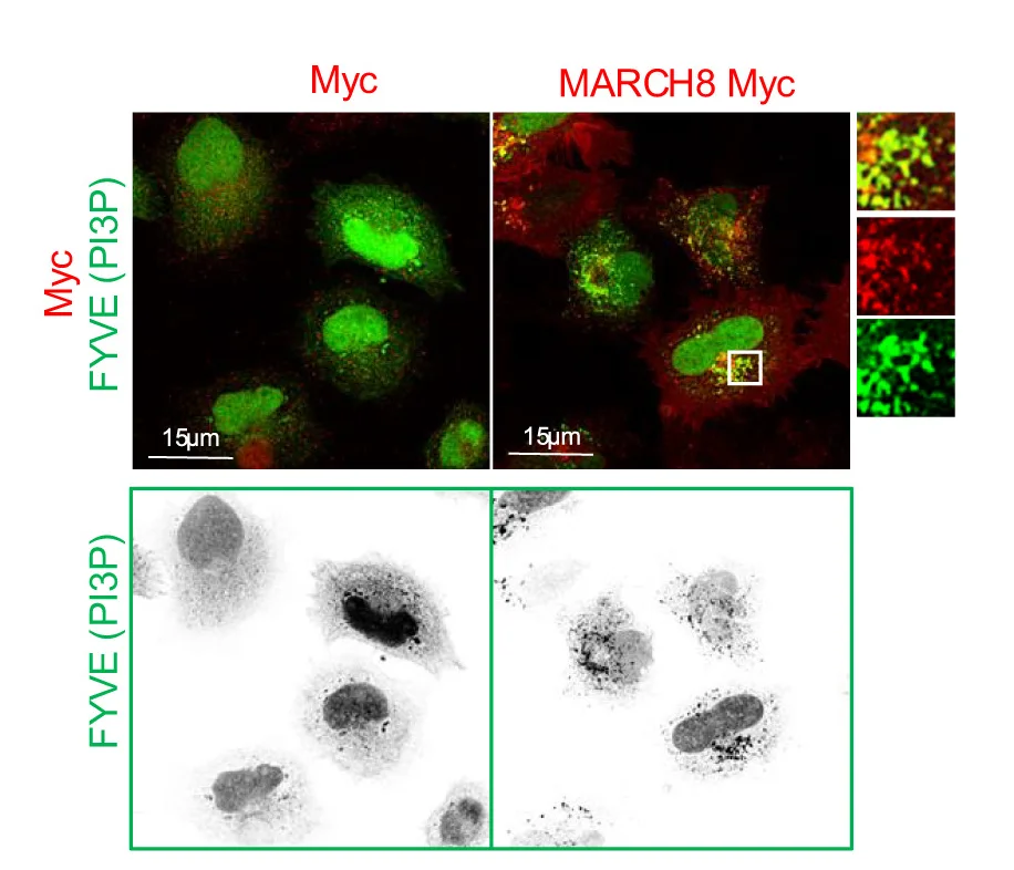 Open access visualization of Microscopy, Photo, HeLa Cells, Myc-Empty Vector, Myc-MARCH8-WT