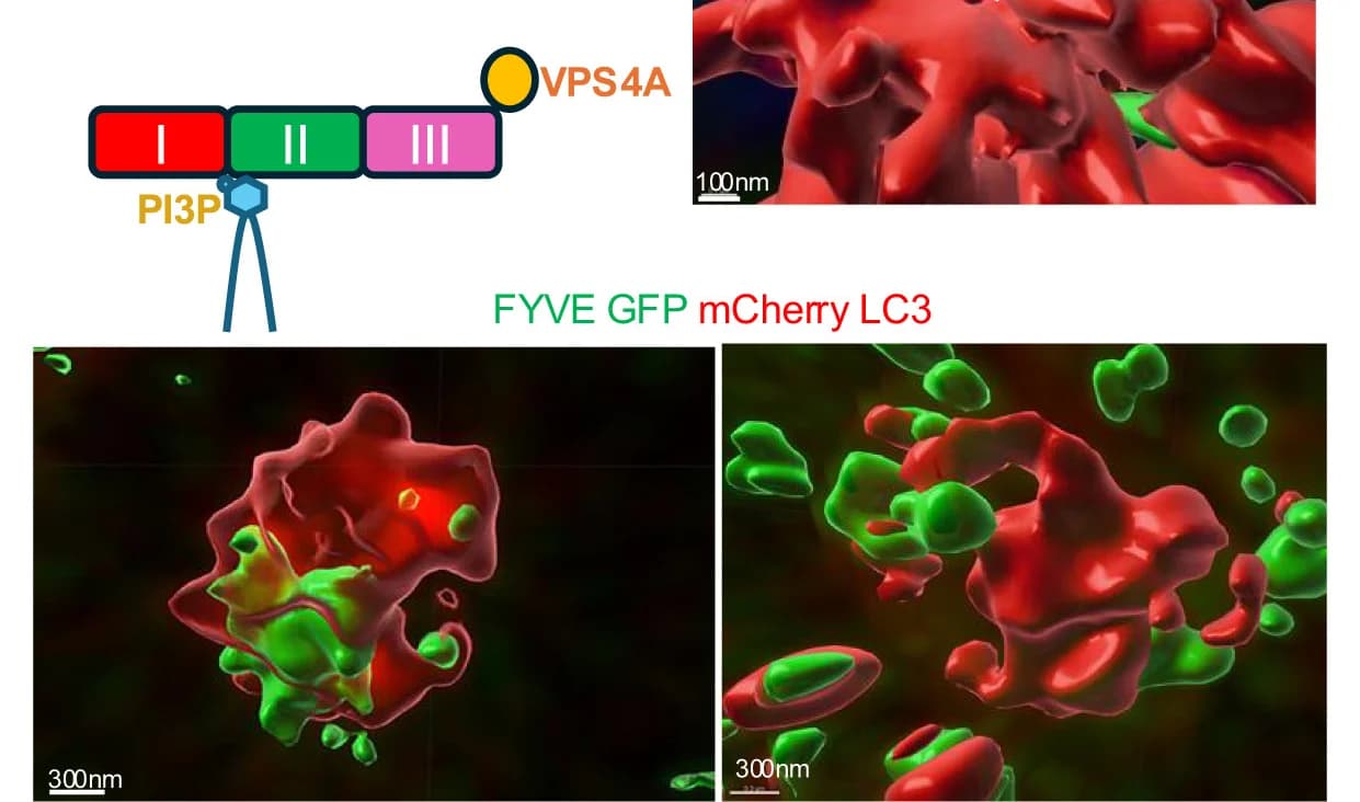 Open access visualization of Microscopy, Illustration, HeLa Cells, 4xFYVE-GFP, mCherry LC3