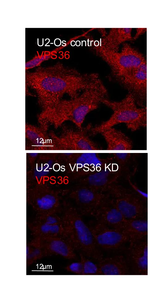 Open access visualization of Microscopy, Immunofluorescence, VPS36, U-2 OS Cells