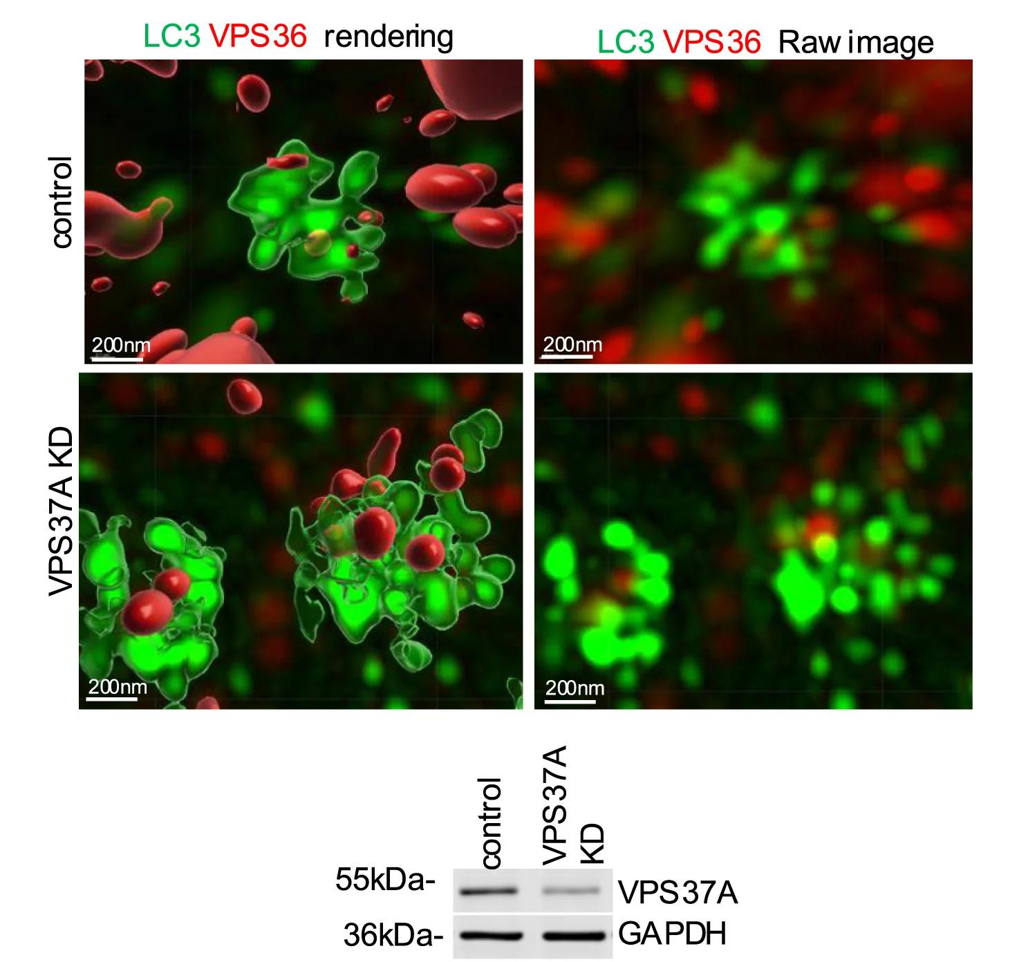 Open access visualization of Microscopy, Gel, HeLa Cells, Control siRNA, siRNA Targeting VPS37A