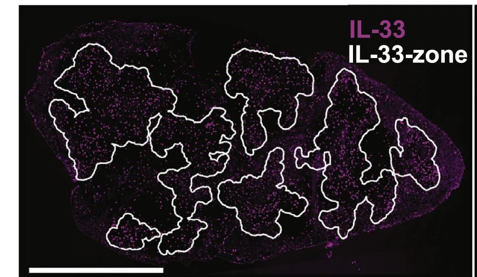 Open access visualization of Microscopy, Cells, LCMV Infection, Spleen, IL-33