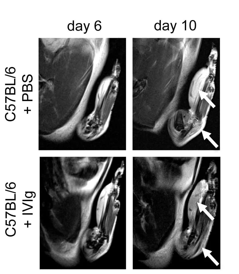 Open access visualization of Microscopy, Mice, KBxN Serum, Inflammatory Arthritis, PBS