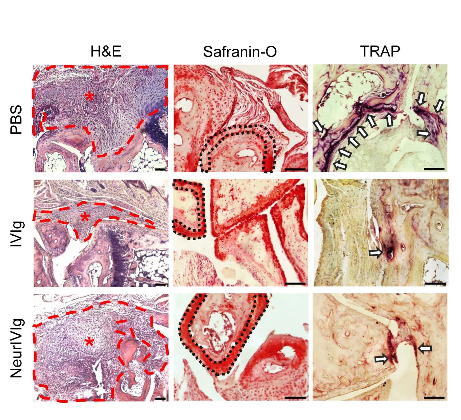 Open access visualization of Microscopy, Tissue Sections, Metatarsal Joints, Pannus Formation, Hematoxylin and Eosin Staining