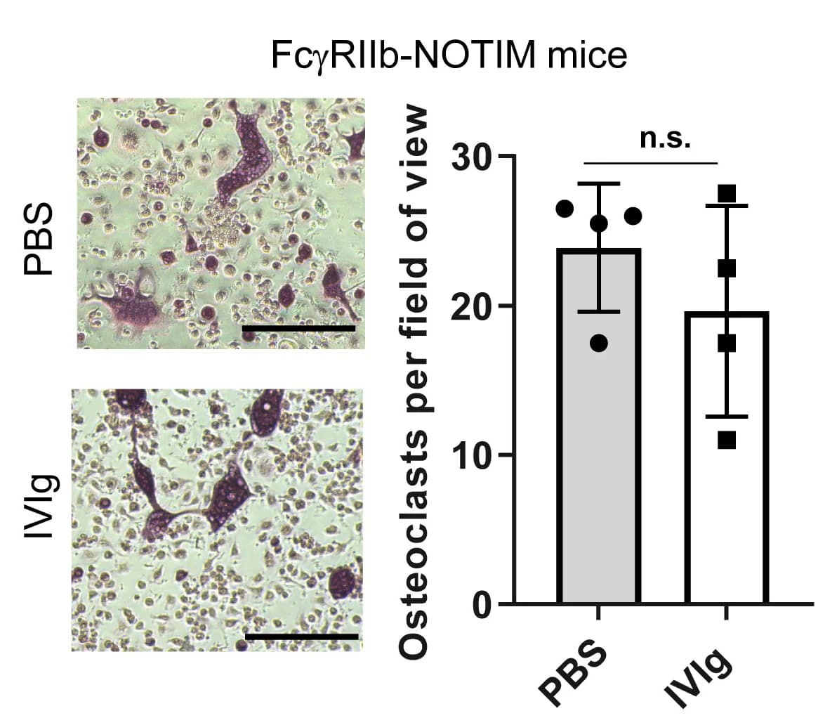 Open access visualization of Bar Plot, Error Bars, TRAP-stained Osteoclast Differentiation Cultures, Osteoclast Numbers, Bone Marrow Cells