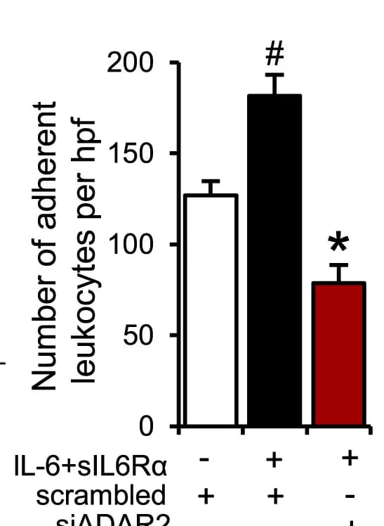 Open access visualization of Bar Plot, Error Bars, Leukocyte Adhesion, HUVECs